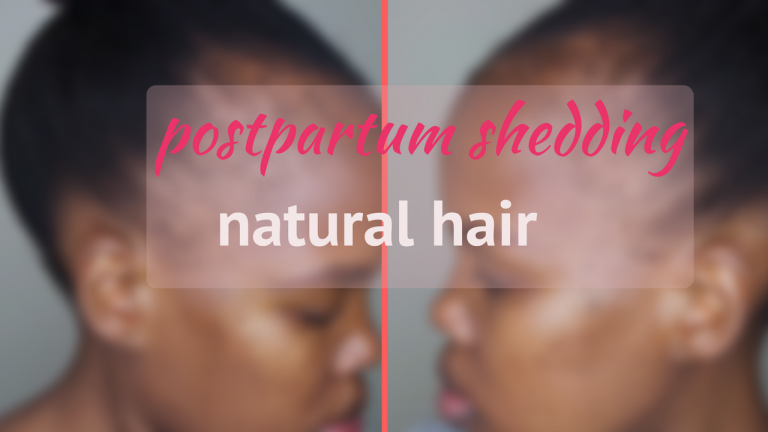 Read more about the article 6 months postpartum shedding update